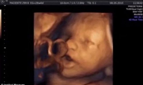 Απίστευτο βίντεο! Έμβρυο «τραγουδά» μέσα στη μήτρα!