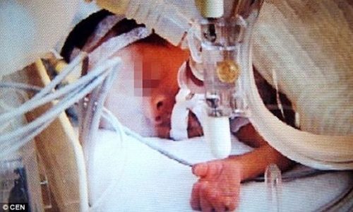 Απίστευτο κι όμως αληθινό: Μωρό ξύπνησε λίγο πριν την αποτέφρωση!