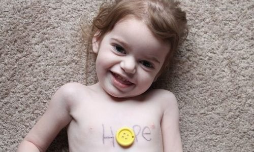 Σπάνιες ασθένειες: Υπολογίζονται σε 7.500 και οι περισσότερες εμφανίζονται στην παιδική ηλικία