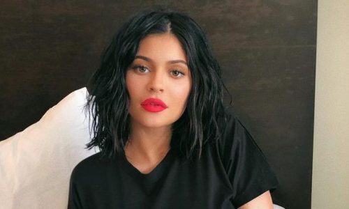 Η Kylie Jenner αφαίρεσε όλα τα εμφυτεύματα από τα χείλη της και η διαφορά είναι μεγάλη!