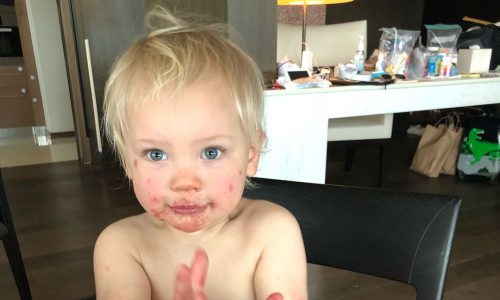 Γιος γνωστής τραγουδίστριας έπαθε μόλυνση σε στομα, χέρια και πόδια (pics)