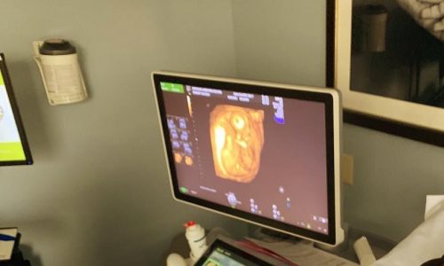 Είναι έγκυος για δεύτερη φορά και το ανακοίνωσε με αυτή τη φωτογραφία (pic)