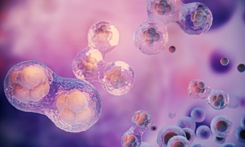 Αποβολή και Κύτταρα Φονείς (ΝΚ) - Νέα επιστημονική πρόταση με ελληνική υπογραφή