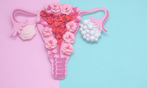 Τι είναι το σύνδρομο υπερδιέγερσης των ωοθηκών (OHSS) και πόσο συχνό είναι;