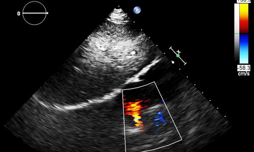 Επιστήμονες κατέγραψαν για πρώτη φορά σε εικόνες τον σχηματισμό καρδιάς σε έμβρυο (βίντεο)