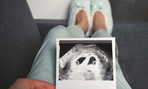 Σημεία «Τ» και «λ» στον υπέρηχο: Τι αποκαλύπτουν για τα δίδυμα