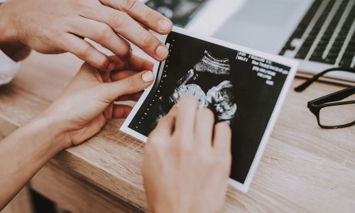 Πώς η ομάδα αίματός σου μπορεί να επηρεάσει την εγκυμοσύνη