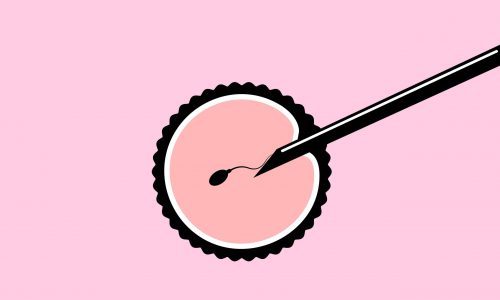 Εξωσωματική γονιμοποίηση: 10 πράγματα που πρέπει να ξέρετε πριν ξεκινήσετε