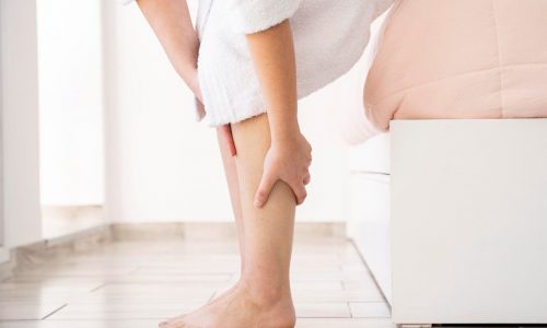 Φλεβική ανεπάρκεια και κιρσοί