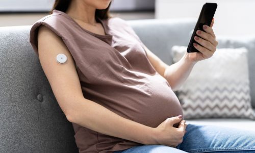 Έρευνα: Τα υψηλά επίπεδα σακχάρου στην εγκυμοσύνη αυξάνουν τον κίνδυνο παχυσαρκίας στα παιδιά