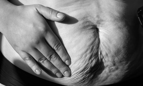 Ανασφάλειες για το σώμα: Η δυσκολία αποδοχής του μετά τη γέννα