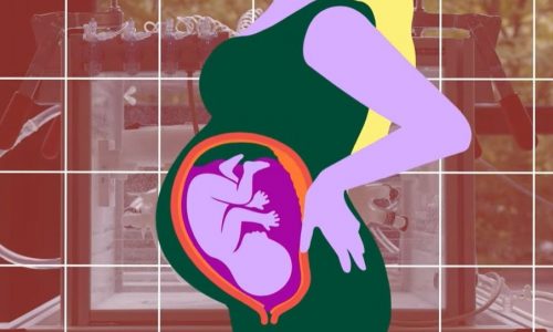 Πώς μια τεχνητή μήτρα επιτρέπει στα πρόωρα μωρά να μεγαλώσουν όπως στην κοιλιά της μαμάς (vid)