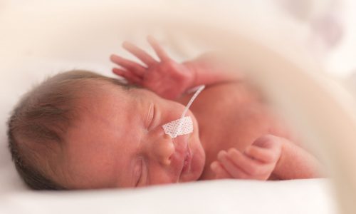 Προωρότητα: Τα συγκλονιστικά στοιχεία για την Ελλάδα και οι πιο γλυκές φωτογραφίες μικρών μαχητών