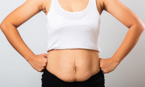 Πέντε μαμάδες μιλούν ανοιχτά για το πώς ένιωσαν με το σώμα τους μετά τον τοκετό