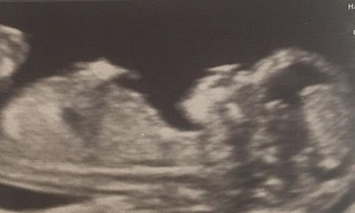 «Το μωρό μας είναι το καλύτερο δώρο που θα μπορούσαμε να κερδίσουμε ποτέ»