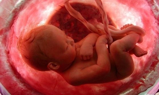 Καλιφόρνια: Δε θα πιστεύετε τι κάνουν με τον ομφάλιο λώρο του νεογέννητου παιδιού τους (εικόνες)