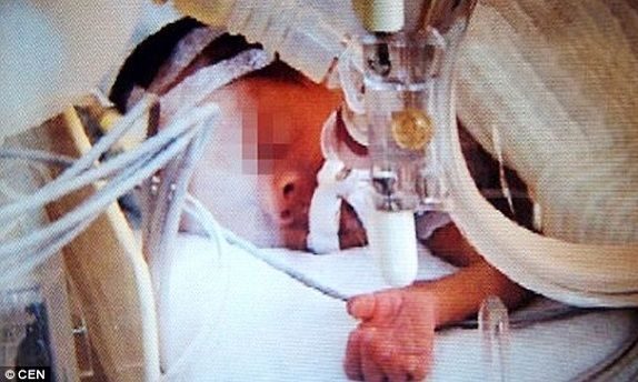 Απίστευτο κι όμως αληθινό: Μωρό ξύπνησε λίγο πριν την αποτέφρωση!