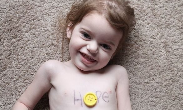 Σπάνιες ασθένειες: Υπολογίζονται σε 7.500 και οι περισσότερες εμφανίζονται στην παιδική ηλικία