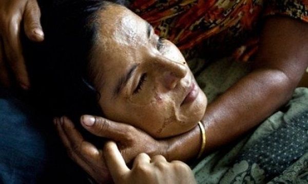 Η «ομορφιά» και η ιστορία μιας ουλής. Φωτογραφίες γυναικών που τους επιτέθηκαν με βιτριόλι