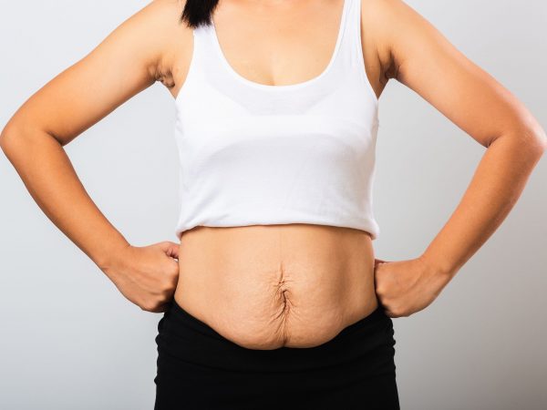 Πέντε μαμάδες μιλούν ανοιχτά για το πώς ένιωσαν με το σώμα τους μετά τον τοκετό