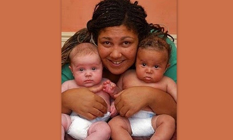 Απίστευτο: Δίδυμα με διαφορετικό χρώμα δέρματος