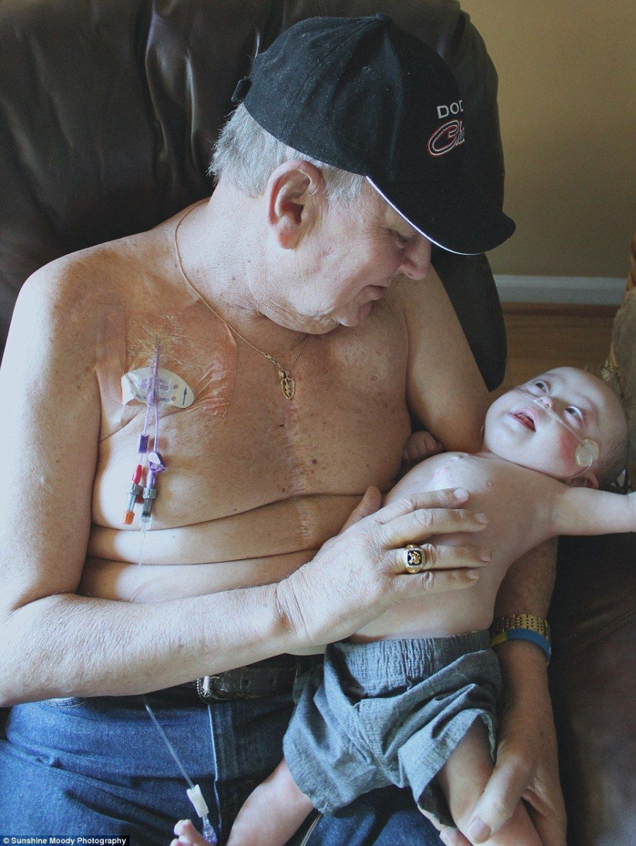 353FC1A400000578 3640138 Fragile The pair have both been through multiple open heart surg a 18 1465877241555 1