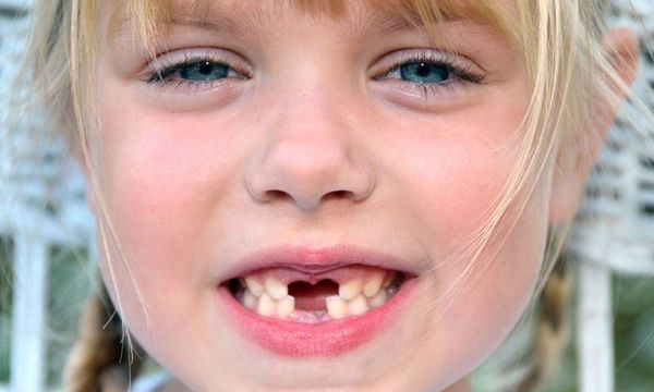 triximo dodion vrigmis